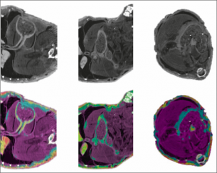 Obr. 4: Obr. 4: Spektrální zobrazovací funkce umožňují identifikaci tkáně i v rekonstruovaných CT datových sadách. Snímky v horní řadě: standardní tomografické řezy Snímky v dolní řadě: Barvy mapují spektrální odezvu tkáně plastifikovaného vzorku myši. Bylo změřeno 200 projekcí na energetických hladinách 10, 15, 25 a 30 keV
