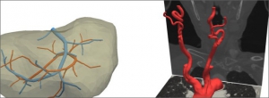 Výzkumníci z fakulty aplikovaných věd pomáhají vyvíjet 3D modely pro výuku mediků