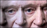 Alzheimerova choroba je nejběžnější formou demence.