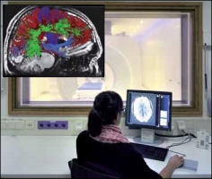 Moderní zobrazovací metody chtějí v mozku zmapovat nejen anatomické celky, ale také systém jeho fungování, včetně většiny či ideálně všech nervových drah. Zdroj: Thirion et al