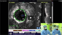 Představení pracoviště invazivní a intervenční kardiologie v Brně - Bohunicích