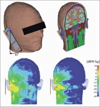 Obr. 1: Numerický model lidské hlavy a specifická míra absorpce výkonu mobilního telefonu