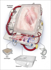 Systém TransMedics® Organ Care