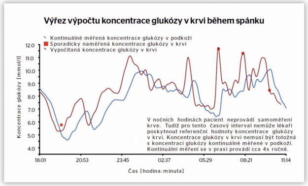 Výřez výpočtu koncentrace glukózy v krvi během spánku