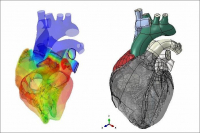 ČVUT se podílí na unikátním medicínském projektu Living Heart