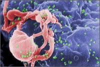 Částice viru HIV unikají z virem napadené a zničené buňky