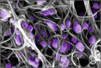Nástroj pro ultracitlivou detekci virů využívá les uhlíkových nanotrubiček