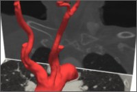 Výzkumníci z fakulty aplikovaných věd pomáhají vyvíjet 3D modely pro výuku mediků Výzkumníci z fakulty aplikovaných věd pomáhají vyvíjet 3D modely pro výuku mediků
