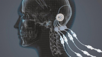 Kovový 3D tisk přináší naději pro léčbu Parkinsonovy choroby Kovový 3D tisk přináší naději pro léčbu Parkinsonovy choroby