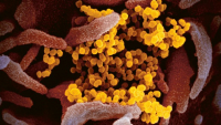 Snímek koronaviru SAR-CoV-2 (žlutě)