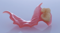Zubní náhražky jsou díky svým drobným rozměrům a vysoké míře nutné customizace podle individuálních potřeb jednotlivých pacientů doslova předurčeny k výrobě pomocí 3D tisku