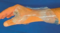 Ortézy a protézy z bioplastů