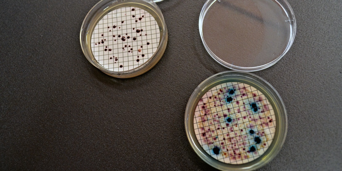 Nová metodika analýzy vody vyvinutá na TUL odhalí patogeny během několika hodin