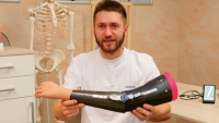 Bionické protézy vracejí pacienty zpět do aktivního života