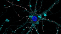 Tekutá protéza s fotoaktivními nanočásticemi nahrazuje poškozenou sítnici /Zdroj:opentalk.iit.it/