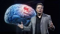Start-up Neuralink založený americkým miliardářem a vizionářem Elonem Muskem vyvinul mozkový čip