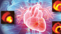 Vylepšená magnetická rezonance zobrazuje metabolismus srdce v reálném čase