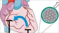 Nové elektrody kardiostimulátoru se po využití rozpustí v těle pacienta
