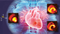 Vylepšená magnetická rezonance zobrazuje metabolismus srdce v reálném čase