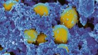 Skenovací elektromikrograf bakterií Staphylococcus aureus © NIAID