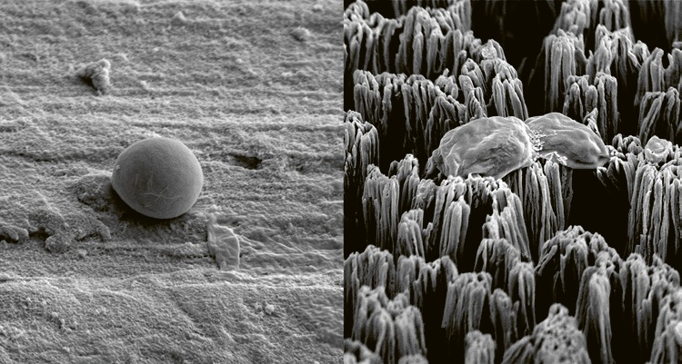 Neporušená buňka Candida na leštěném titanovém povrchu (vlevo) a prasklá buňka Candida na titanovém povrchu s mikrohroty (vpravo) © RMIT