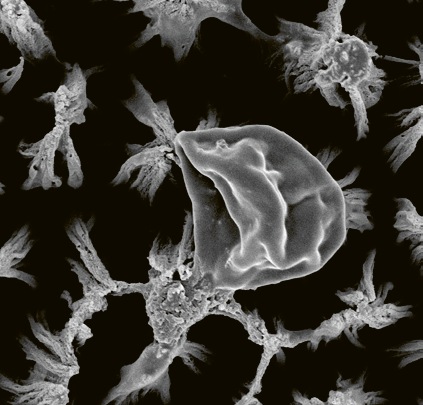 Prasklá buňka Candida na titanových mikrohrotech, zvětšená 25 000× © RMIT