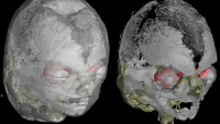 3D atlas chrupavky lidských embryí ve druhém trimestru 3D atlas chrupavky lidských embryí ve druhém trimestru