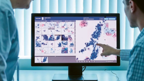 O analýzu cytologického screeningu se už postará umělá inteligence