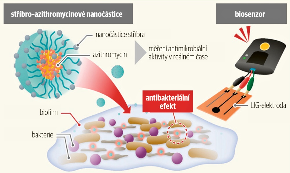 Nanočástice stříbra v kombinaci s konvenčním antibiotikem a stabilizací polymerem spolupracují na poškození buněčných stěn bakterií v biofilmech © National Institute of Advanced Industrial Science and Technology (AIST)