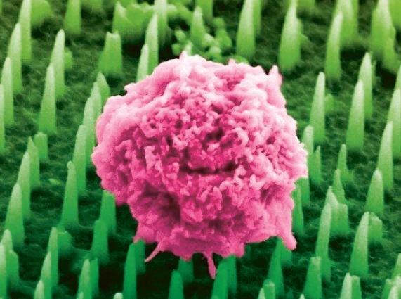 Náplast nabízí bezbolestnou a méně invazivní alternativu pro miliony pacientů po celém světě, kteří každoročně podstupují biopsie k detekci a sledování onemocnění, jako jsou např. rakovina či Alzheimerova choroba © KCL