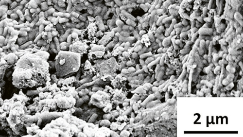 Biovstřebatelná baterie využívá probiotika a není toxická