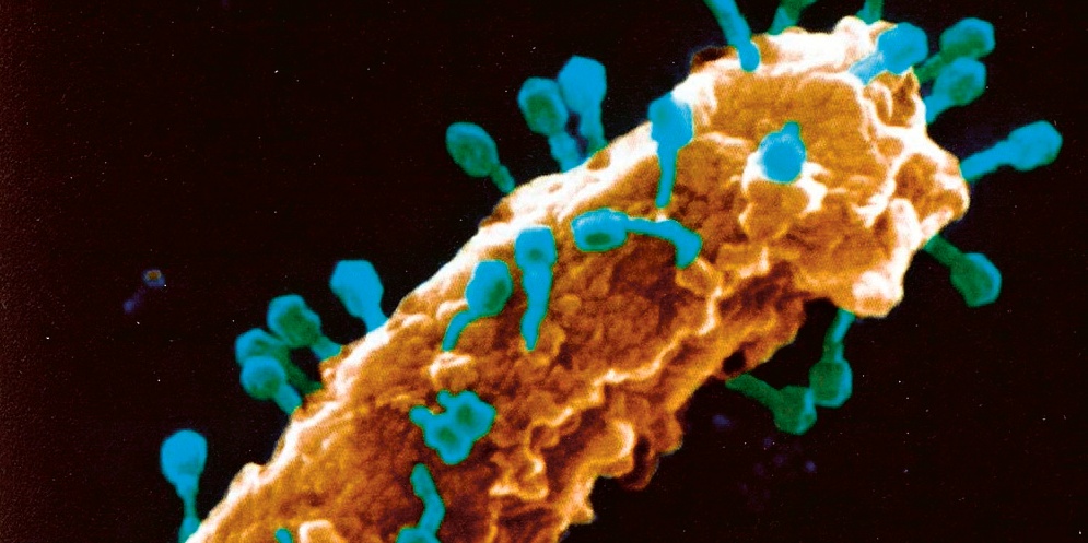 Bakteriofágy (fialově) napadající bakteriální buňku. Snímek byl dodatečně obarven pro přehlednost © Center for Phate Technology, Texas A&M