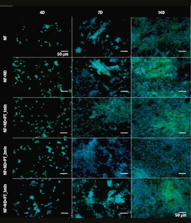 Fluorescenční mikroskopické snímky fibroblastů po 4, 7 a 14 dnech kultivace; měřítko 50 μm