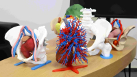 Lékaři využívají před komplikovanými výkony 3D modely orgánů a kostí