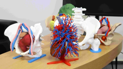 Lékaři využívají před komplikovanými výkony 3D modely orgánů a kostí
