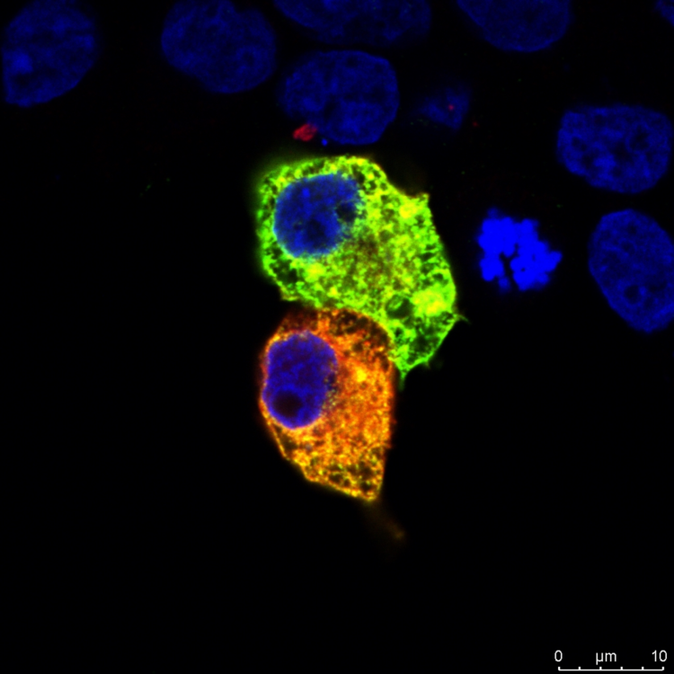 VL v buňce (zelená), enzym upravující DVL (červená), buněčné jádro (modrá) | Foto: Tripsianes Lab, CEITEC
